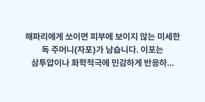 오키나와 해파리 쏘임 사고: 해파리에게 쏘이면 피부에 보... (1)
